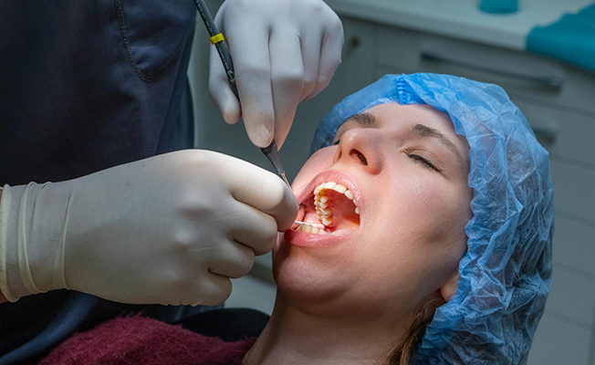 Denture fitting