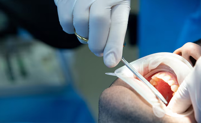 Denture fabrication