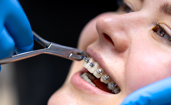 Dental consultation